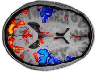 fMRI.jpg